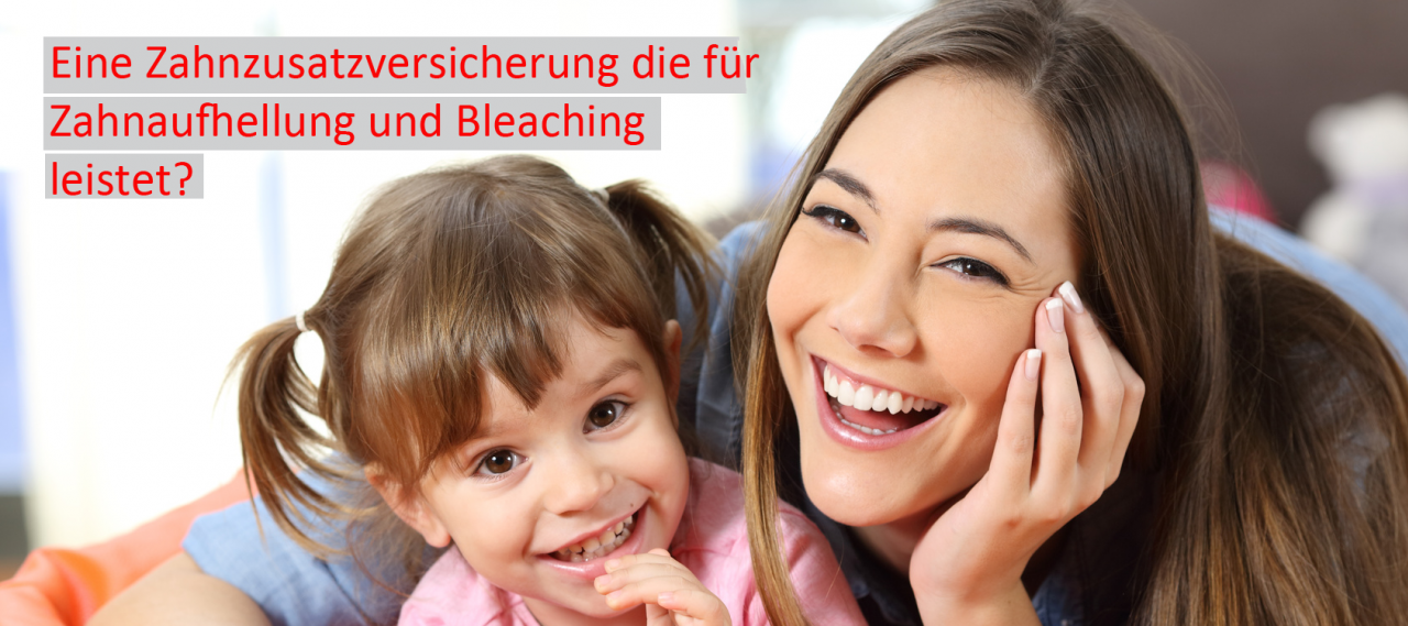 Leistet auch für Bleaching und Zahnaufhellung